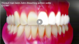 SWR-Video zum Thema Zahnaufhellung - Startbild